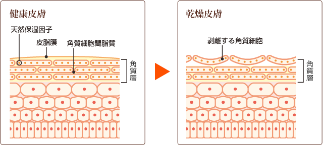 健康皮膚 乾燥皮膚